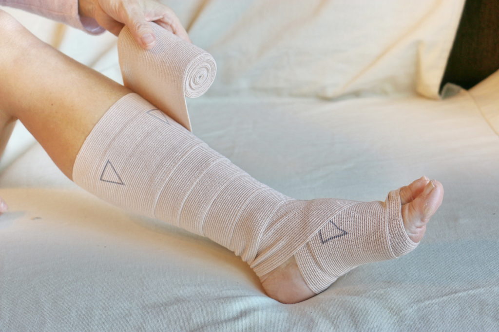 a bandaged up leg after leg ulcer surgery