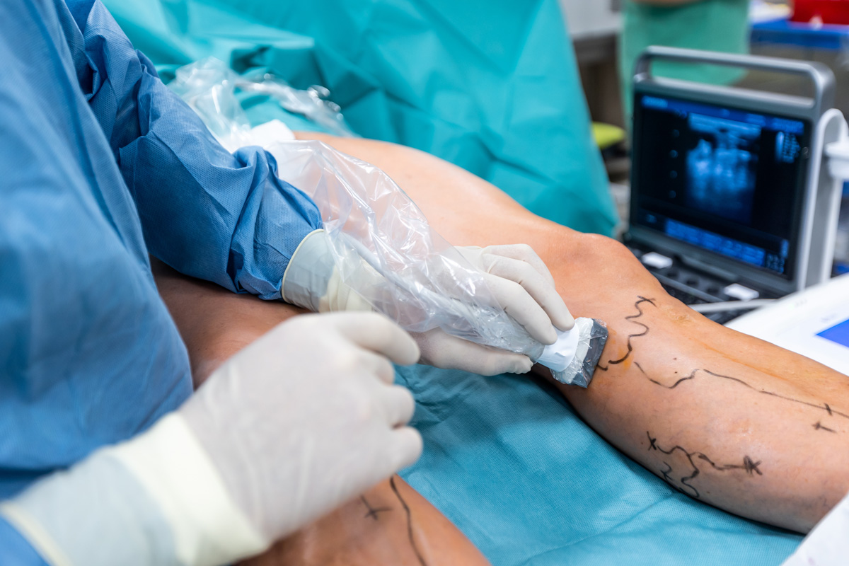 A vascular surgeon performing a procedure on a patient’s leg that is marked with a marker in El Paso.